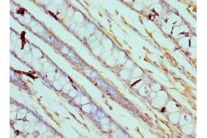 Immunohistochemistry of paraffin-embedded human colon tissue using ABIN7146544 at dilution of 1:100