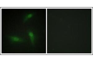 Immunofluorescence analysis of HeLa cells, using hnRNP A1 Antibody. (HNRNPA1 Antikörper)