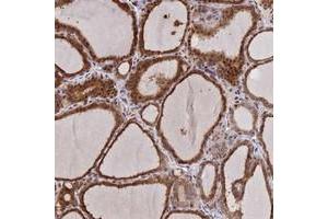 Immunohistochemical staining of human thyroid gland with UFSP2 polyclonal antibody  shows strong cytoplasmic and nuclear positivity in glandular cells at 1:500-1:1000 dilution.