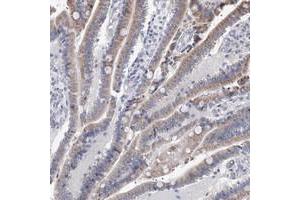 Immunohistochemical staining of human duodenum with PPRC1 polyclonal antibody  shows moderate cytoplasmic positivity in glandular cells at 1:500-1:1000 dilution. (PPRC1 Antikörper)