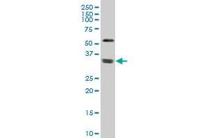 ZIC4 monoclonal antibody (M12), clone 3G4 Western Blot analysis of ZIC4 expression in Jurkat . (ZIC4 Antikörper  (AA 1-90))