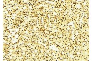 ABIN6276347 at 1/100 staining Mouse liver tissue by IHC-P. (SIRT2 Antikörper  (C-Term))