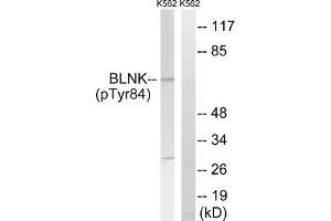 Western blot analysis of extracts from K562 cells, treated with starved (24hours), using BLNK (Phospho-Tyr84) antibody. (B-Cell Linker Antikörper  (pTyr84))