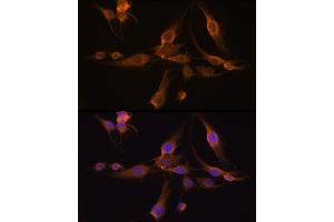 Immunofluorescence analysis of C6 cells using GST Rabbit pAb (8266) at dilution of 1:100 (40x lens). (GSTA1 Antikörper  (AA 1-222))