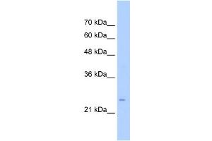 WB Suggested Anti-TMEM69 Antibody Titration:  0. (TMEM69 Antikörper  (Middle Region))
