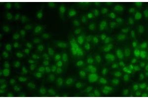 Immunofluorescence analysis of A549 cells using KLF3 Polyclonal Antibody (KLF3 Antikörper)