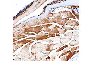 IHC analysis of PBEF/NAMPT using anti-PBEF/NAMPT antibody (AZE7F8T6).