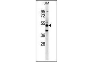Western blot analysis of PNLIPRP3 Antibody (N-term) Cat. (PNLIPRP3 Antikörper  (N-Term))