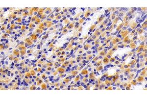 Immunohistochemistry (IHC) image for anti-Keratin 7 (KRT7) (AA 394-457) antibody (ABIN7437020)