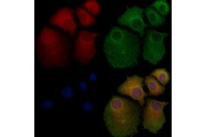 ABIN6261285 and ABIN6276758 staining Hela cells by IF/ICC. (Dihydrofolate Reductase Antikörper)