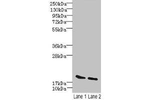 Western blot All lanes: SKP1 antibody at 15 μg/mL Lane 1: Mouse brain tissue Lane 2: Hela whole cell lysate Secondary Goat polyclonal to rabbit IgG at 1/10000 dilution Predicted band size: 19 kDa Observed band size: 19 kDa (SKP1 Antikörper  (AA 2-163))