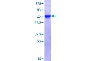 Image no. 1 for Phosphoglycerate Kinase 1 (PGK1) (AA 1-417) protein (GST tag) (ABIN1314808)