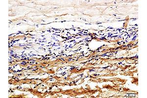 Formalin-fixed and paraffin embedded rabbit sclera tissue labeled with Rabbit Anti-CD31/PECAM-1 Polyclonal Antibody (ABIN726140) at 1:600 followed by conjugation to the secondary antibody and DAB staining.