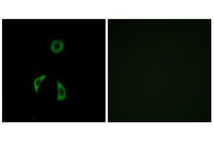Immunofluorescence analysis of A549 cells, using FZD3 antibody. (FZD3 Antikörper  (Internal Region))