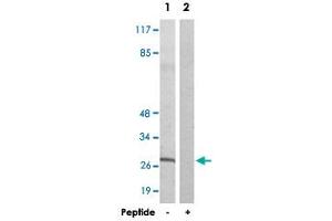 Western blot analysis of extracts from NIH/3T3 cells, using KDELR3 polyclonal antibody . (KDELR3 Antikörper)