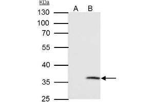 IP Image VDAC2 antibody [C2C3], C-term immunoprecipitates VDAC2 protein in IP experiments. (VDAC2 Antikörper  (C-Term))
