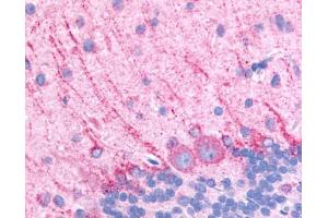 Anti-DRD5 / Dopamine Receptor D5 antibody IHC of rat brain, Purkinje neurons. (DRD5 Antikörper  (Extracellular Domain))