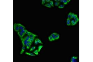 Immunofluorescent analysis of PC-3 cells using ABIN7157524 at dilution of 1:100 and Alexa Fluor 488-congugated AffiniPure Goat Anti-Rabbit IgG(H+L) (KIR3DL1 Antikörper  (AA 81-336))