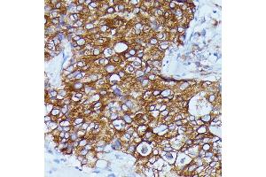 Immunohistochemistry (IHC) image for anti-DEAD (Asp-Glu-Ala-Asp) Box Polypeptide 6 (DDX6) (C-Term) antibody (ABIN7266704)