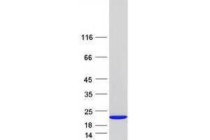 Western Blotting (WB) image for Fragile Histidine Triad (FHIT) (Transcript Variant 2) protein (Myc-DYKDDDDK Tag) (ABIN2721127)