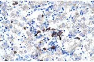 Human kidney (Activator of Basal Transcription 1 Antikörper  (Middle Region))