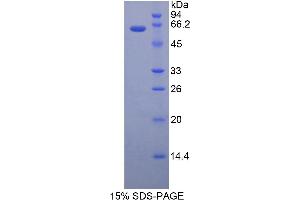 SDS-PAGE (SDS) image for Telomerase Reverse Transcriptase (TERT) (AA 642-974) protein (His tag,GST tag) (ABIN1877624)