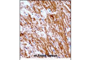 Mouse Pdk2 Antibody (N-term) ((ABIN657996 and ABIN2846942))immunohistochemistry analysis in formalin fixed and paraffin embedded mouse heart tissue followed by peroxidase conjugation of the secondary antibody and DAB staining.