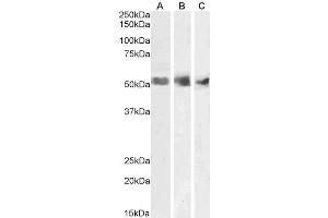 ABIN185674 (1µg/ml) staining of Human Spleen (A), Kidney (B) and Testis (C) lysates (35µg protein in RIPA buffer). (WT1 Antikörper  (N-Term))