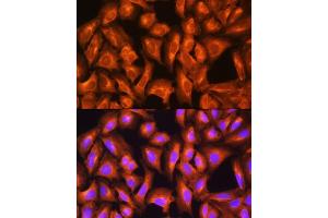 Immunofluorescence (IF) image for anti-GNAS Complex Locus (GNAS) (AA 1-394) antibody (ABIN6141213)