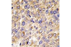 Immunohistochemistry (IHC) image for anti-GABA(A) Receptor-Associated Protein (GABARAP) (AA 1-30) antibody (ABIN3031014)