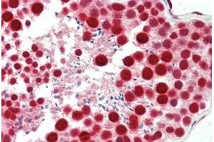 Human Testis: Formalin-Fixed, Paraffin-Embedded (FFPE)