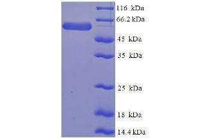 SDS-PAGE (SDS) image for serpin Peptidase Inhibitor, Clade B (Ovalbumin), Member 1 (SERPINB1) (AA 1-379), (full length) protein (His-SUMO Tag) (ABIN5710338) (SERPINB1 Protein (AA 1-379, full length) (His-SUMO Tag))