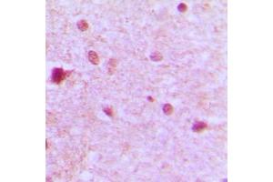 Immunohistochemical analysis of ZFP36L1 staining in human brain formalin fixed paraffin embedded tissue section. (ZFP36L1 Antikörper  (Center))