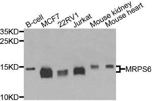Western blot analysis of extracts of various cell lines, using MRPS6 antibody (ABIN6003616) at 1/1000 dilution. (MRPS6 Antikörper)
