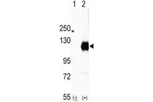 Western blot analysis of EphA2 antibody and 293 cell lysate (2 ug/lane) either nontransfected (Lane 1) or transiently transfected with the EphA2 gene (2). (EPH Receptor A2 Antikörper  (AA 919-950))