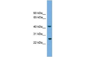 WB Suggested Anti-RAB35 Antibody Titration: 0. (RAB35 Antikörper  (Middle Region))