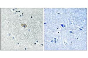 Immunohistochemistry (IHC) image for anti-Glutamate Receptor, Ionotropic, N-Methyl D-Aspartate 1 (GRIN1) (pSer890) antibody (ABIN1847319) (GRIN1/NMDAR1 Antikörper  (pSer890))