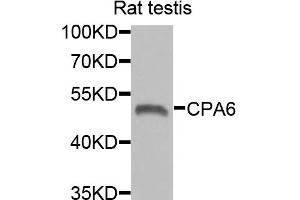 Western blot analysis of extracts of rat testis, using CPA6 antibody.