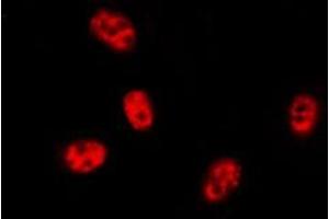 ABIN6276437 staining HEPG2 cells by ICC/IF.