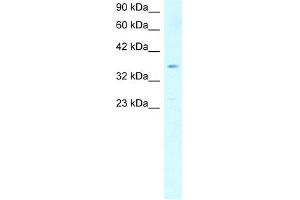 WB Suggested Anti-SCD Antibody Titration:  1. (SCD Antikörper  (Middle Region))