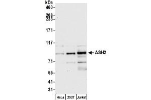 Western Blotting (WB) image for anti-Achaete-Scute Complex Homolog 2 (ASCL2) (AA 225-275) antibody (ABIN7454590) (ASCL2 Antikörper  (AA 225-275))