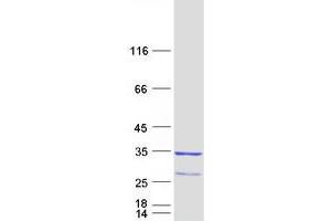 Validation with Western Blot (RAB23 Protein (Transcript Variant 2) (Myc-DYKDDDDK Tag))