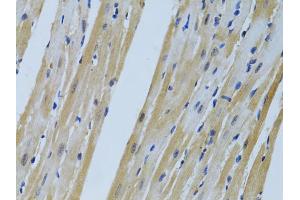 Immunohistochemistry of paraffin-embedded mouse heart using FHL2 antibody (ABIN5975345) at dilution of 1/100 (40x lens).