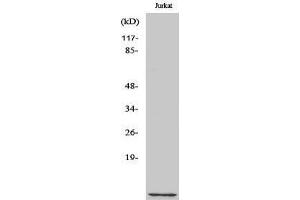 Western Blotting (WB) image for anti-CDC28 Protein Kinase Regulatory Subunit 1B (CKS1B) (N-Term) antibody (ABIN3174414) (CKS1 Antikörper  (N-Term))