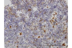 Immunostaining (ISt) image for anti-Gardner-Rasheed Feline Sarcoma Viral (V-Fgr) Oncogene Homolog (FGR) (AA 1-90) antibody (ABIN560883)