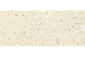 Immunohistochemistry of paraffin-embedded Human brain tissue using SPIRE1 Polyclonal Antibody at dilution of 1:60(x200)