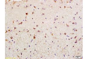 Formalin-fixed and paraffin embedded rat brain labeled with Rabbit Anti BAG2 Polyclonal Antibody, Unconjugated (ABIN755347) at 1:200 followed by conjugation to the secondary antibody and DAB staining (BAG2 Antikörper  (AA 151-211))