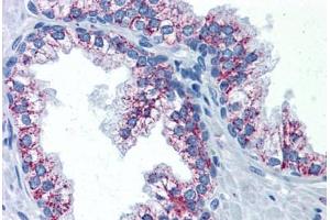 Human Prostate: Formalin-Fixed, Paraffin-Embedded (FFPE) (TAO Kinase 2 Antikörper  (AA 831-931))