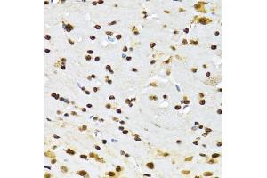 Immunohistochemistry of paraffin-embedded mouse brain using CCAR2 antibody (ABIN2563550) at dilution of 1:100 (40x lens). (CCAR2 Antikörper)