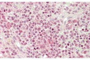 anti-Chemokine (C-X-C Motif) Ligand 2 (CXCL2) (AA 34-107) antibody